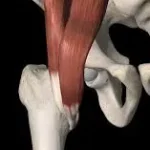 درد کشاله ران پس از تعویض مفصل ران: علل شایع، تشخیص و مدیریت مؤثر