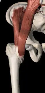 درد کشاله ران پس از تعویض مفصل ران: علل شایع، تشخیص و مدیریت مؤثر